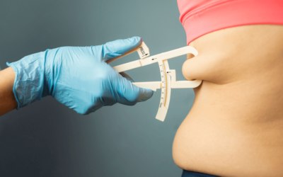 Dê adeus a gordura localizada com a Intradermoterapia!