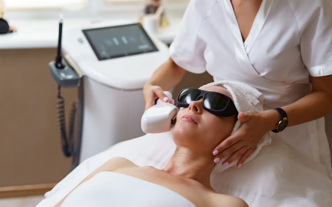 Laserterapia CO2: indicações e benefícios do laser CO2 fracionado