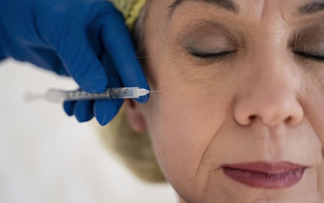 Bioestimulador de colágeno: saiba os benefícios para os pacientes