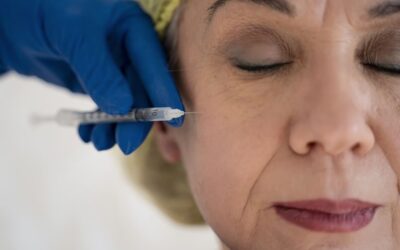 Bioestimulador de colágeno: saiba os benefícios para os pacientes