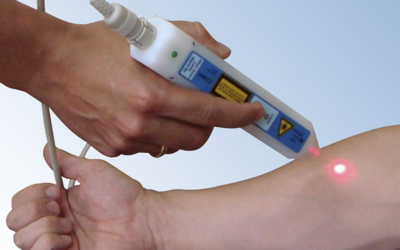 Eletroterapia e laser: como a tecnologia potencializa resultados estéticos com base científica